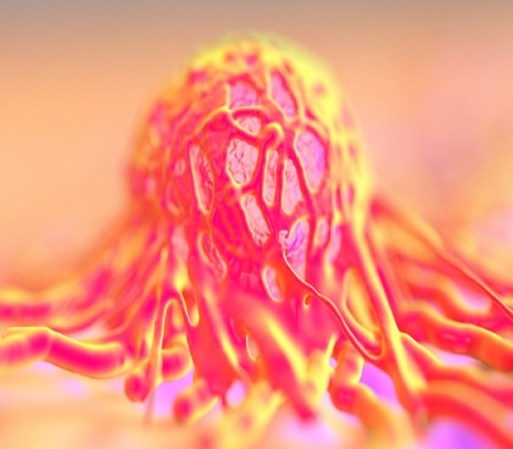 La prueba de Papanicolaou y la prueba del virus de papiloma humano (VPH) son usadas para esto.