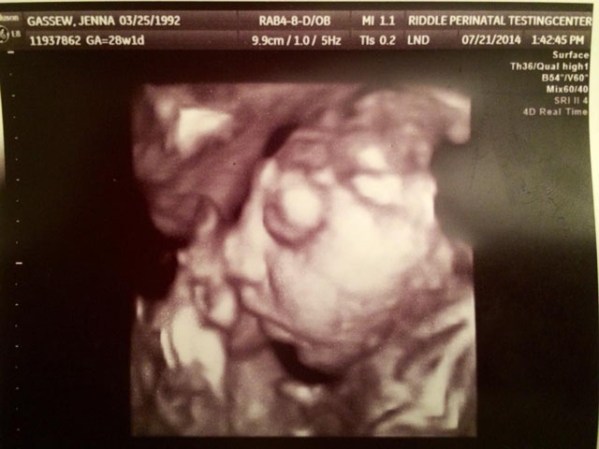 Jenna fue alertada sobre buscar información en la web, porque las imágenes de bebes anencefálicos, que nacen sin una parte del cerebro y el cráneo, son gráficas.