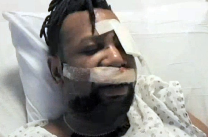 17 DE JULIO, 2013: Un hombre de Brooklyn se encuentra en grave estado de salud tras ser atacado con un martillo.