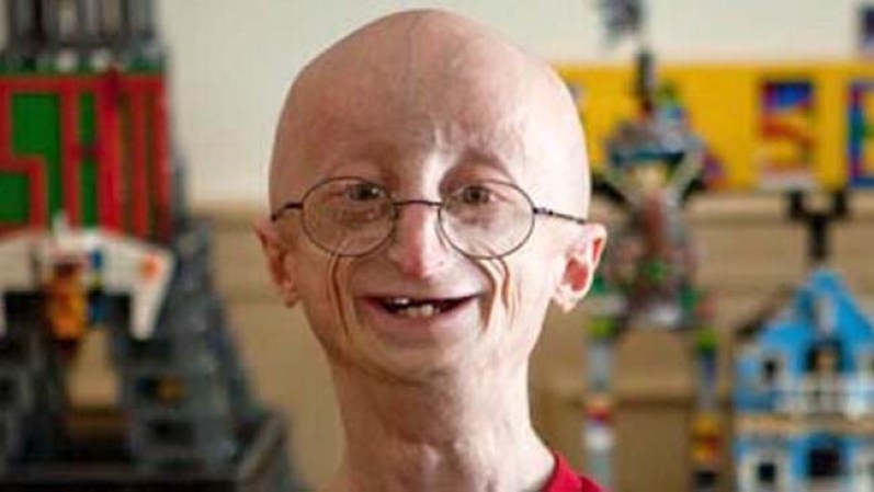 14 DE JUNIO, 2013 - Sam Berns, el adolescente con la enfermedad conocida como Progeria, será enterrado el martes en Massachusetts.