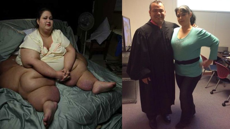 Mayra Rosales es una habitante de Houston que ha perdido más de 800 libras de peso en un año y medio. Cirugías y ejercicio físico la sacaron de la cama de donde no se podía parar. Te presentamos las más recientes fotos de ella.