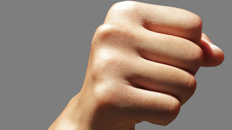Una nueva moda está cobrando fuerza. Se trata del "Knockout Game" o "juego del KO", en el que un desconocido agrede con el puño a una víctima escogida al azar con el objetivo de derribarla.