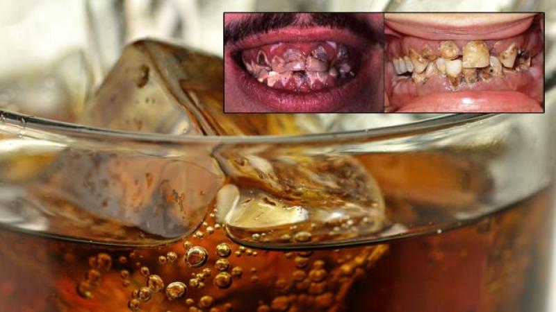 Estudio: sodas tan dañinas como crack