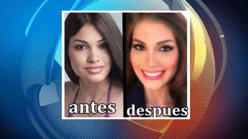 Miss Universo: coronan al cirujano