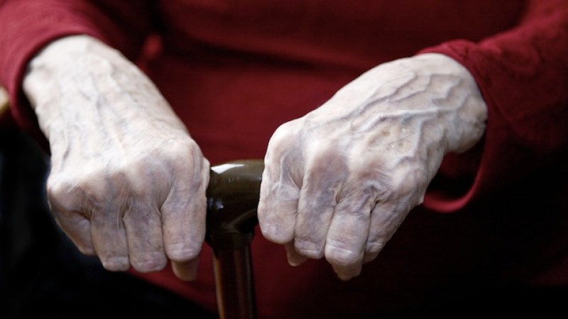 Hasta ahora no se había podido establecer un diagnóstico concluyente del Alzheimer.