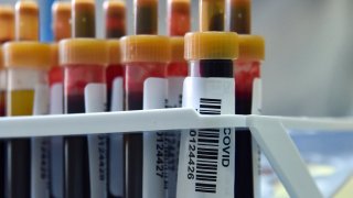 Blood samples to test for COVID-19 antibodies sit on a table at a clinic