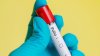Nueva York declara estado de emergencia por la poliomielitis para aumentar la tasa de vacunación
