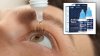 Los CDC reportan nueva muerte relacionada a gotas para los ojos contaminadas