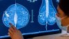 Nuevas reglas de la FDA para la realización de mamografías ayudarían a detectar el cáncer de seno