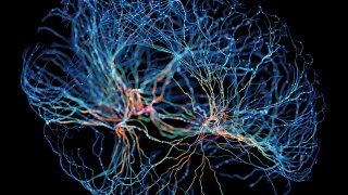 Sistema de neuronas