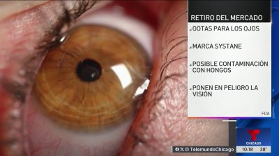 Retiro del mercado: gotas para ojos por posible contaminación por hongos