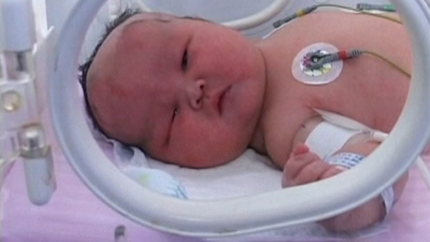 Video: Nace un bebé obeso en China