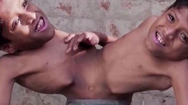 Video: Estos siameses... ¡no quieren separarse!