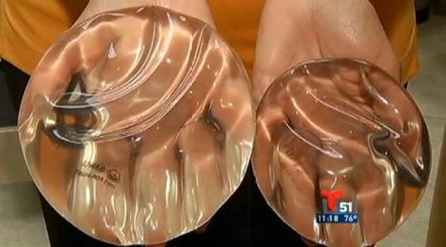 Video: Los implantes de seno y el cáncer